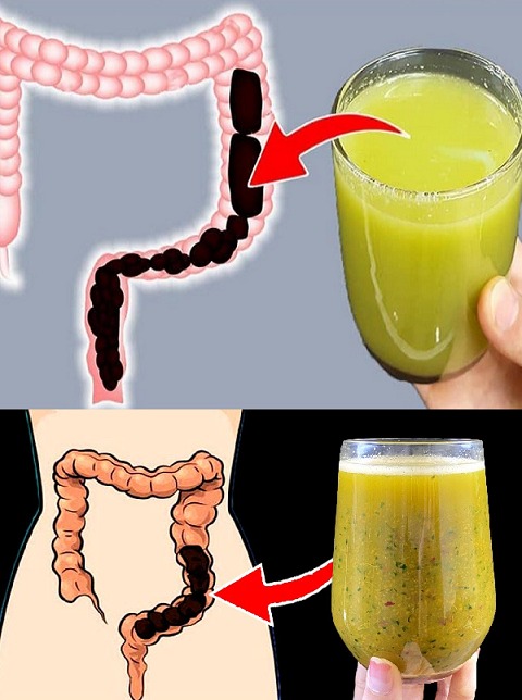 Lose Weight by Cleansing Your Colon