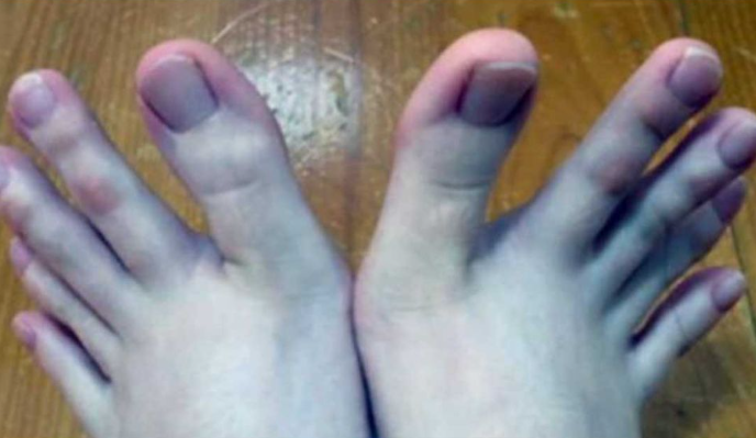 The Internet Is Going Crazy Over This Lady's Feet. Here's Why